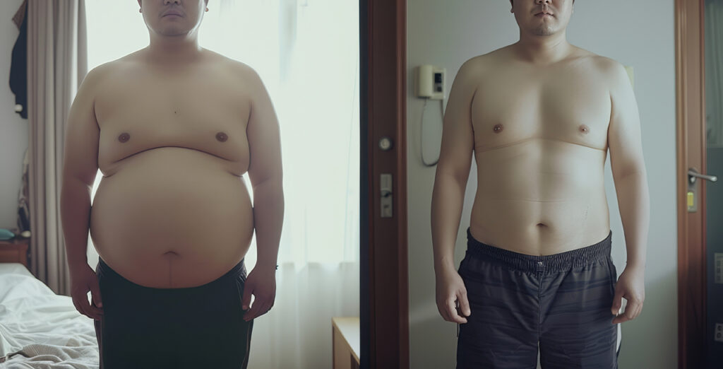 산양컷 복용 전과 후의 복부 모습 비교