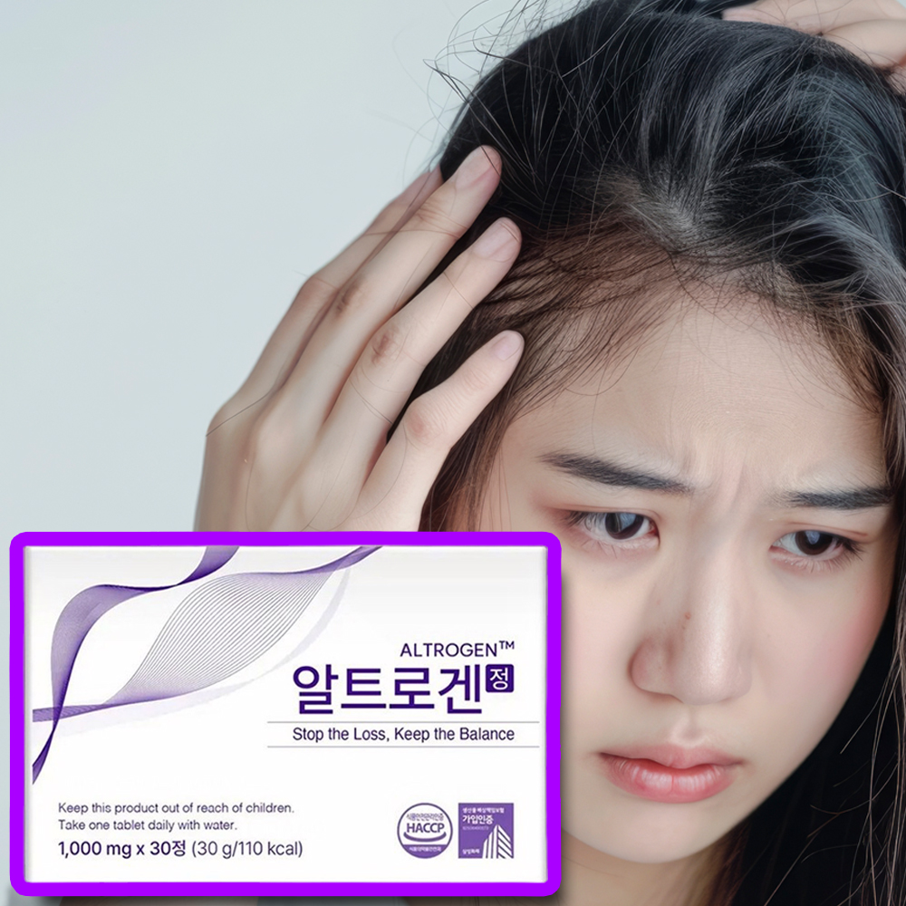 알트로겐 내돈내산 산후탈모 3개월 후기 약국 효능 부작용 효과 정리